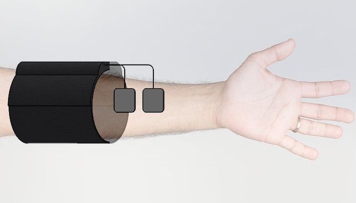 FES_Armcuff
